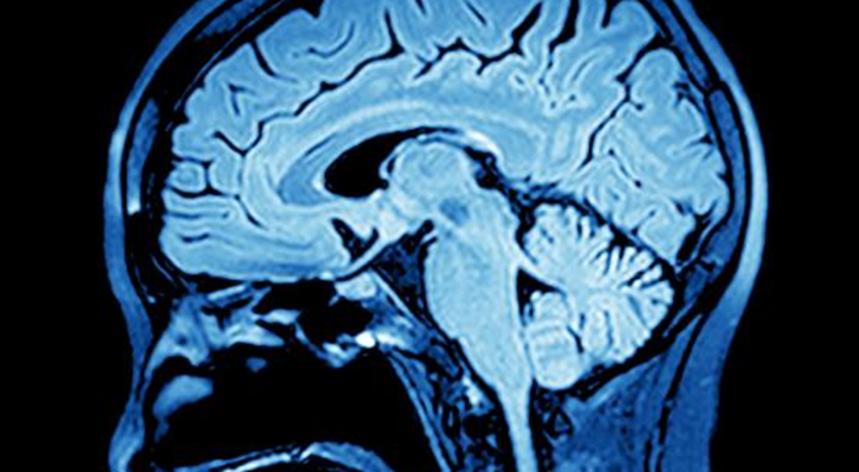 人工智能是精密醫學(xué)成像的最大增長(cháng)機會(huì )