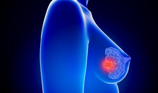 基于A(yíng)I的乳腺攝影工具獲得FDA的支持