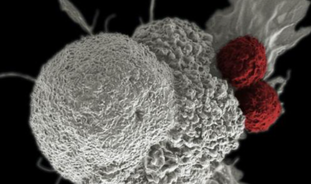 深度學(xué)習以改善針對癌癥和其他疾病的免疫療法