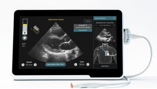 醫療AI公司Caption Health任命新首席執行官